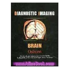 Diagnostic ultrasound imaging: inside out