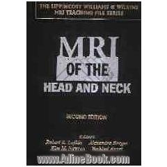 MRI of the head and neck