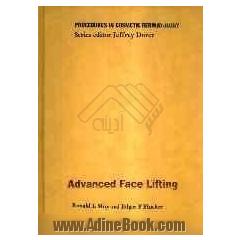 Advanced face lifting