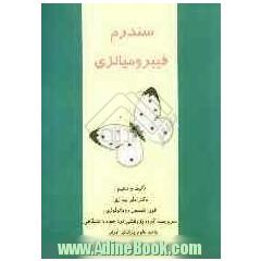 سندرم فیبرومیالژی