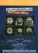 اطلس ساختمان های طبیعی مغز در MRI و PET scan