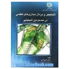 تشخیص و درمان بیماری های تنفسی در مصدومین شیمیایی