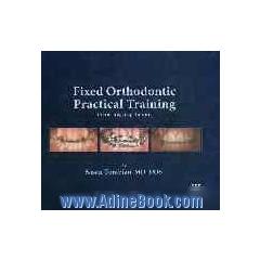 Fixed orthodontic practical training from the beginning to the end
