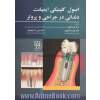 اصول کلینیکی ایمپلنت دندانی در جراحی و پروتز