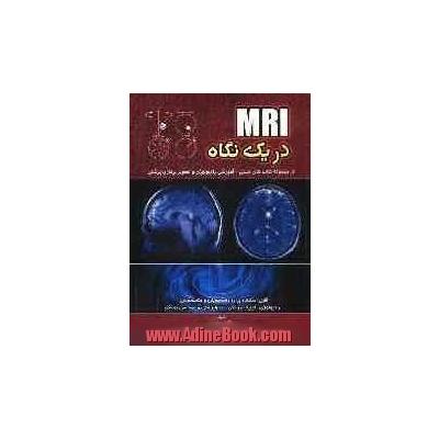 MRI در یک نگاه (از مجموعه کتاب های تستی - آموزشی رادیولوژی و تصویربرداری پزشکی) ...