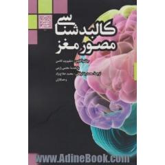 کالبدشناسی مصور مغز