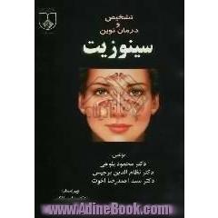 تشخیص و درمان نوین سینوزیت