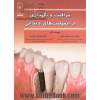 مراقبت و نگهداری از ایمپلنت های دندانی