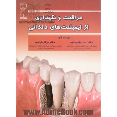 مراقبت و نگهداری از ایمپلنت های دندانی