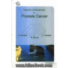 Diagnosis and management of prostate cancer