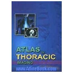 Atlas of thoracic imaging