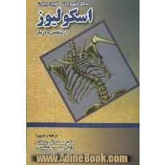 اسکولیوز: از تشخیص تا درمان